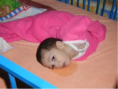 a child in a crib whose posture is bent backwards