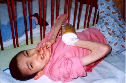 Emaciated, bedridden child in crib biting one hand and plastic liter bottle taped to the other hand