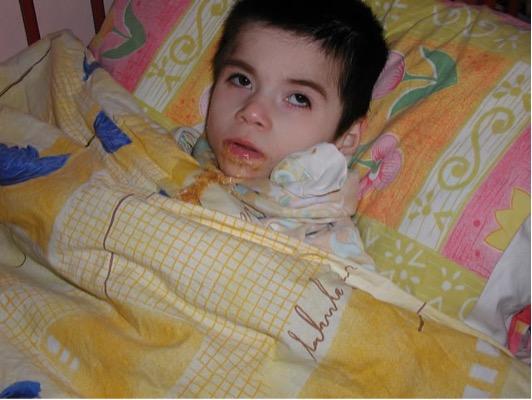 child in bed with vomit on his face and sheets